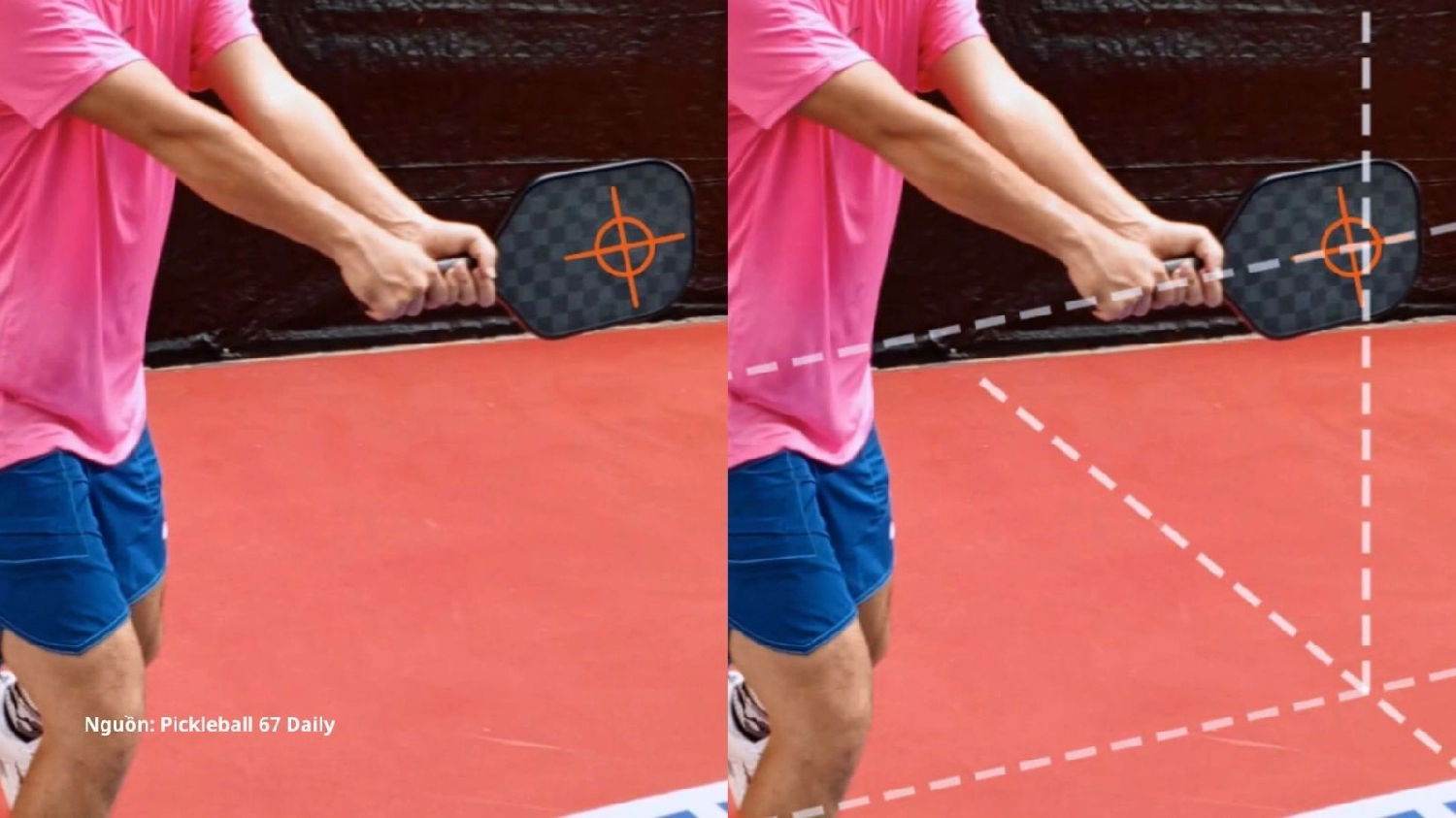 Kỹ thuật đỡ giao bóng Backhand Pickleball